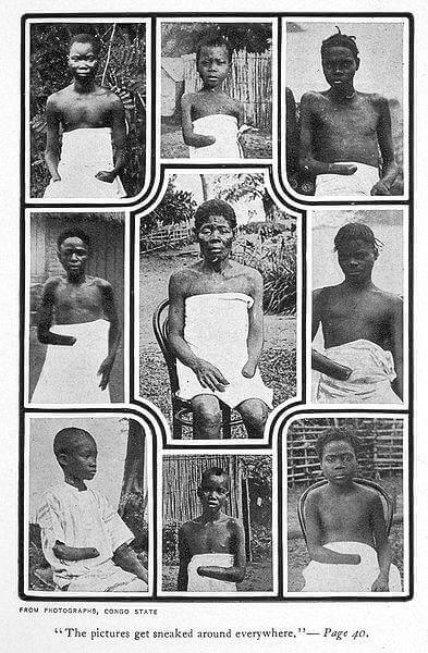 Des enfants mutilés du Congo, photographie publiée en 1905